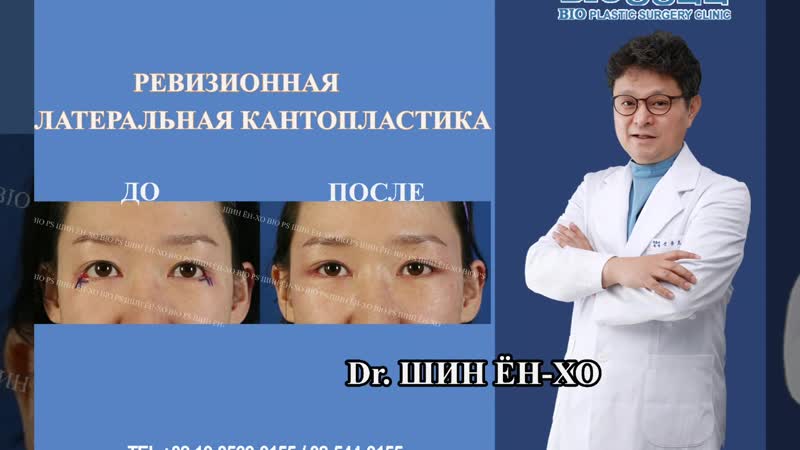 Bios clinic ворошкевич. клиника пластической хирургии биос. биос пластическая хирургия. операция липофилинг лица. биос пластическая хирургия.