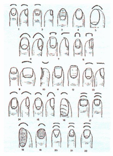 О каких заболеваниях говорят наши ногти Здоровый ноготь ровный и гладкий розового цвета с матовым оттенком с лункой в форме небольшого полумесяца. Лунки в детстве есть на каждом пальце и это